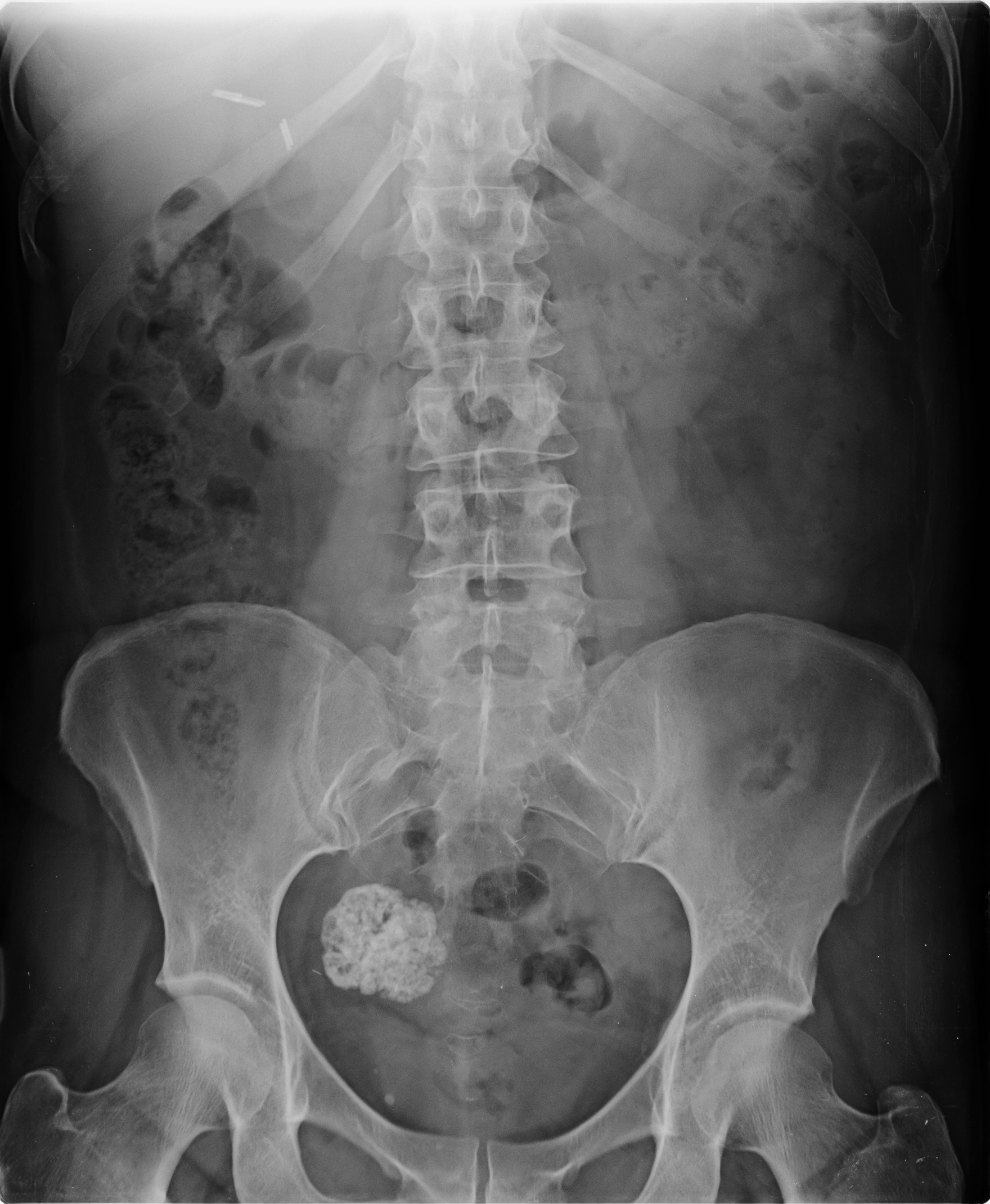 Radiología para